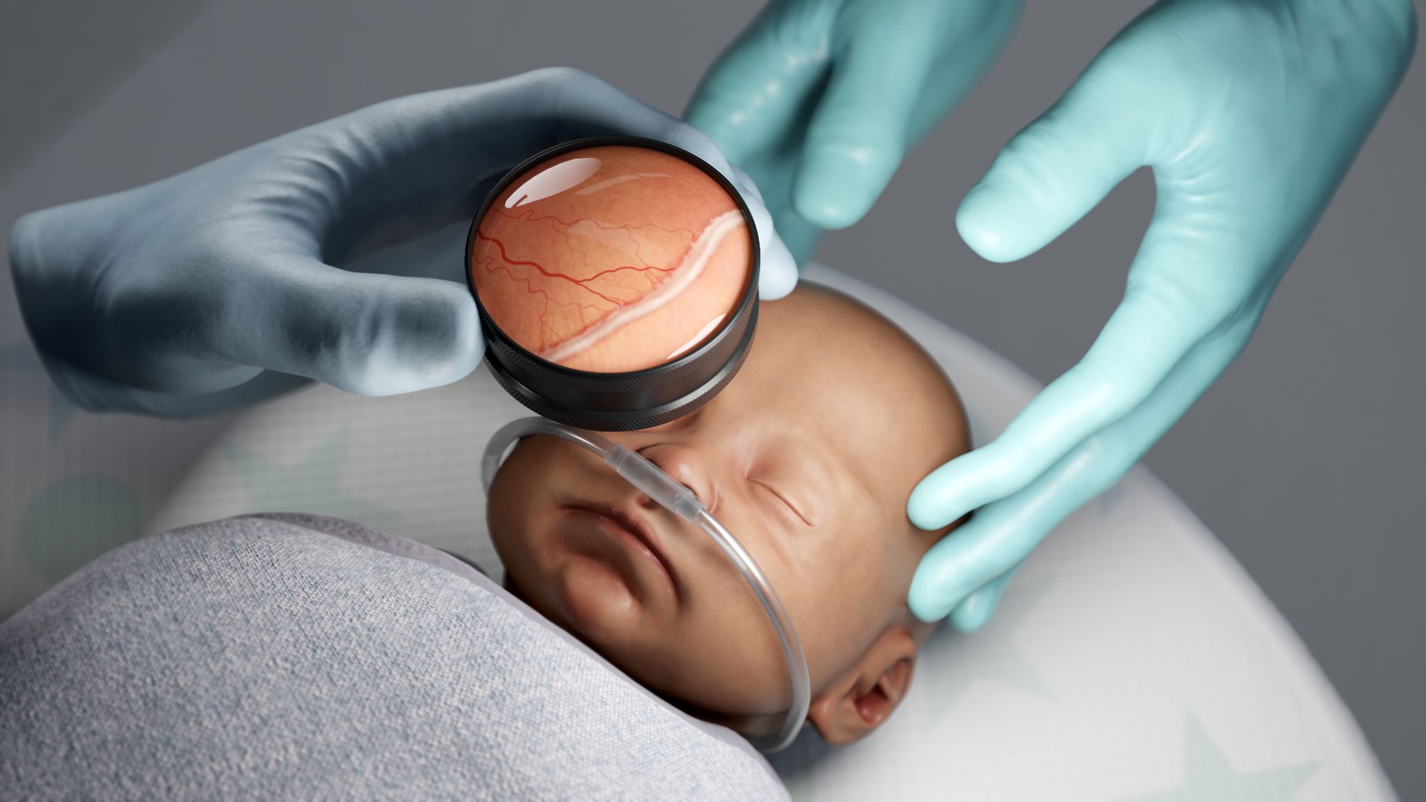 Simulated retinopathy of prematurity eye exam on an infant, with a magnified retinal fundus view through the ophthalmoscopy lens